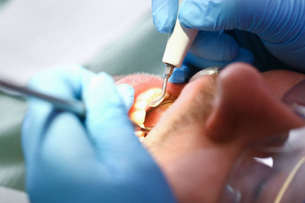 Best Emergency Care for Gum Disease in Crosby, ND