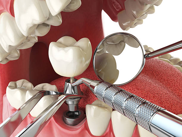 Best Emergency Treatment for Jaw Pain or Injury in Crosby, ND