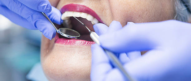 Best Emergency Dental Care for Sports Injuries in Crosby, ND